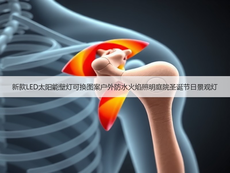 新款LED太阳能壁灯可换图案户外防水火焰照明庭院圣诞节日景观灯
