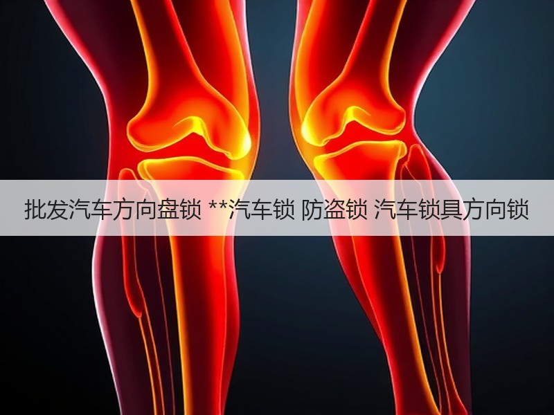 批发汽车方向盘锁 **汽车锁 防盗锁 汽车锁具方向锁 批发汽车方向盘锁 **汽车锁 防盗锁 汽车锁具方向锁